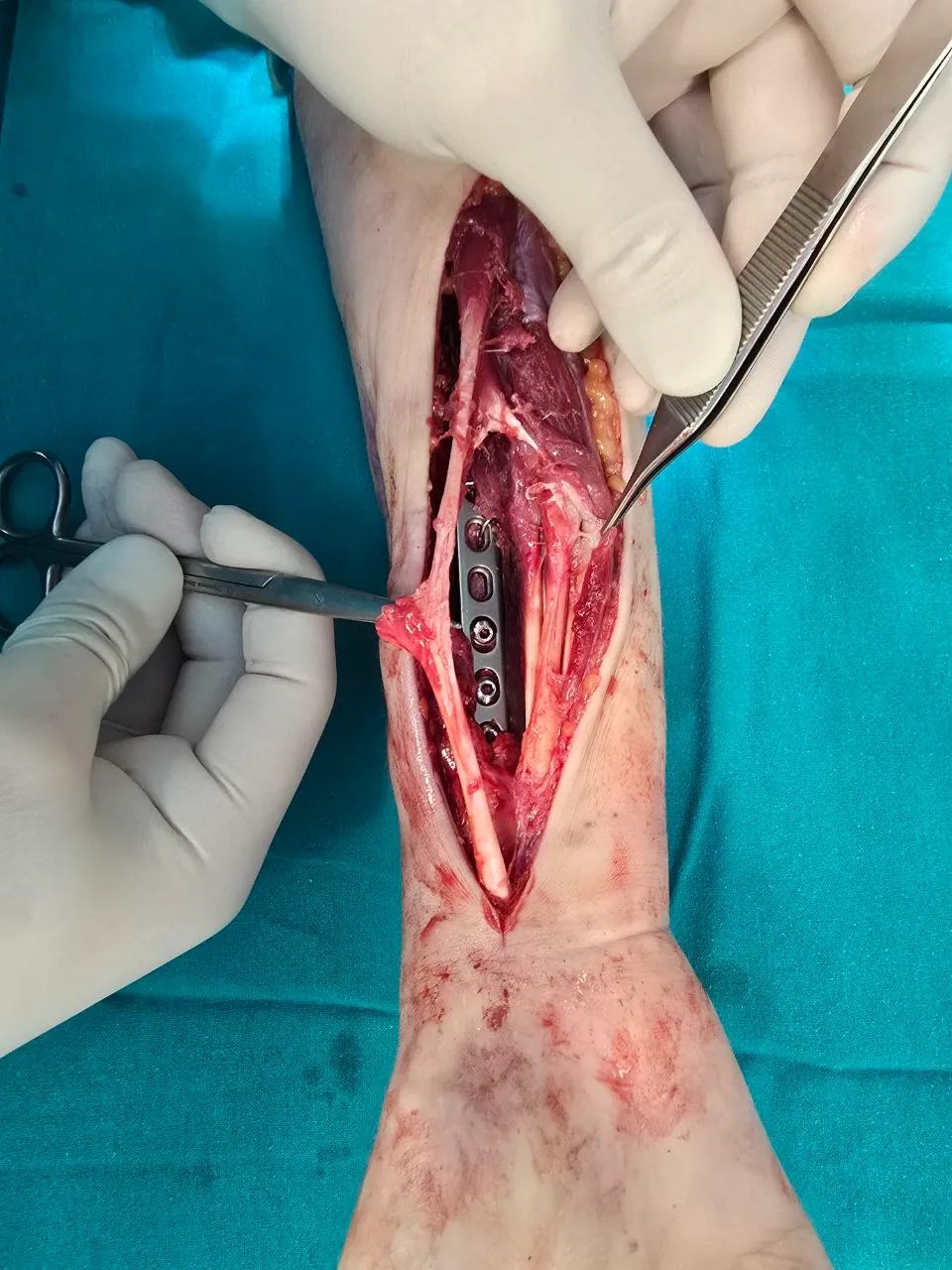 Восстановительная хирургия