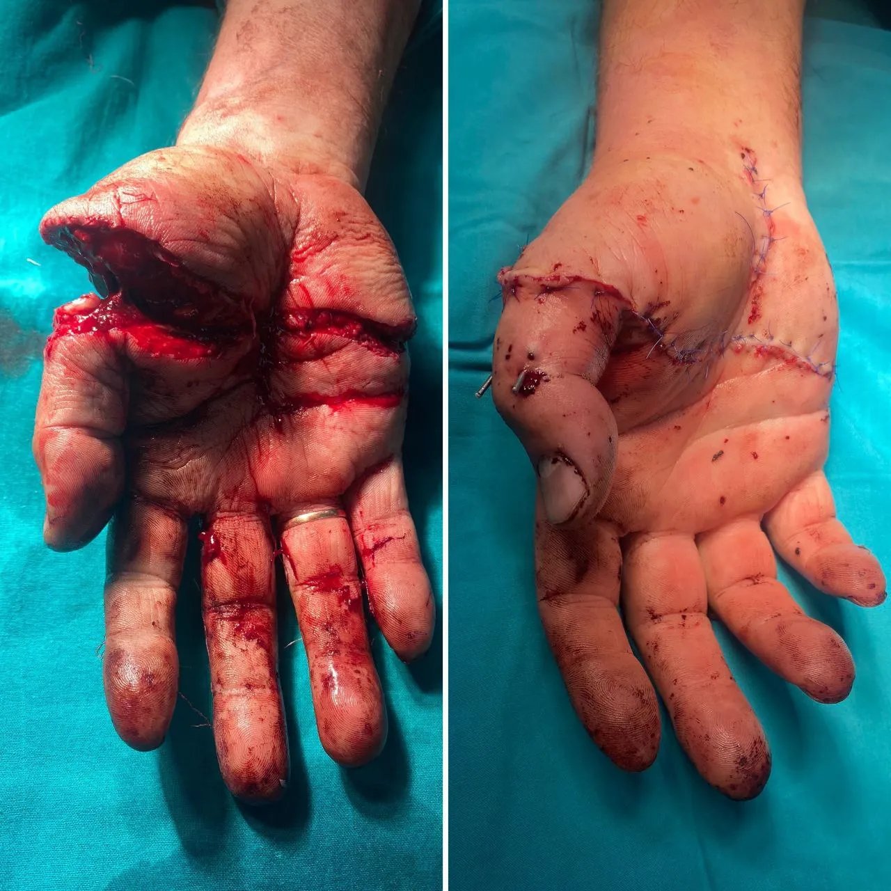 Восстановительные операции